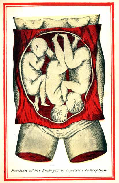 Position of the Embryos in a plural conception