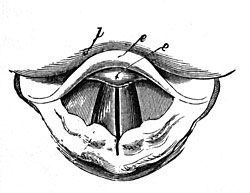 FIG. 193.—The vibration of the vocal cords produces
the sound of the human voice.