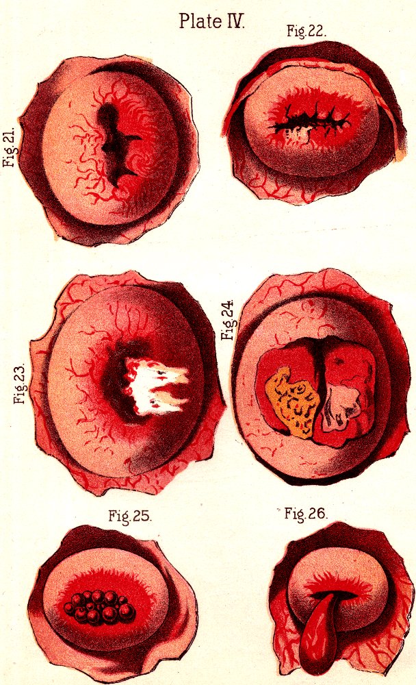 Illustration:
Fig. 22. Fig. 21. Fig. 23. Fig. 24. Fig. 25. Fig. 26.