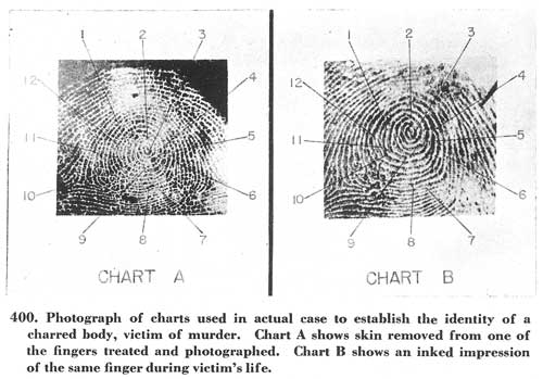 Fig. 400