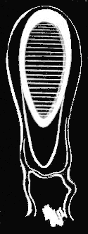 Fig. 116. Oil float of Nanomia; greatly magnified.