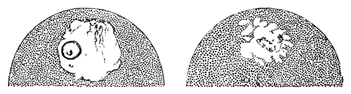 Two successive stages