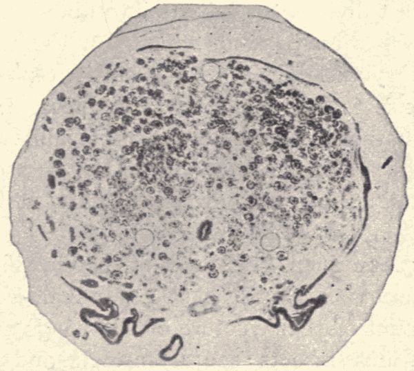 A cross-section.